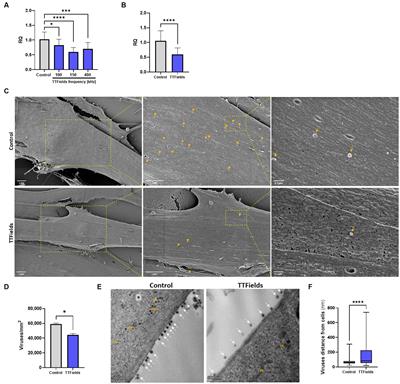 Tumor Treating Fields (TTFields) demonstrate antiviral functions in vitro, and safety for application to COVID-19 patients in a pilot clinical study